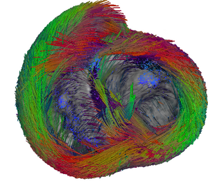 Fibre atlas