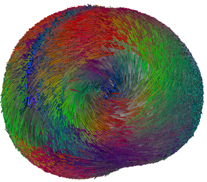 Fibre atlas