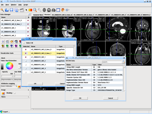 CardioViz3D: screenshot n. 12