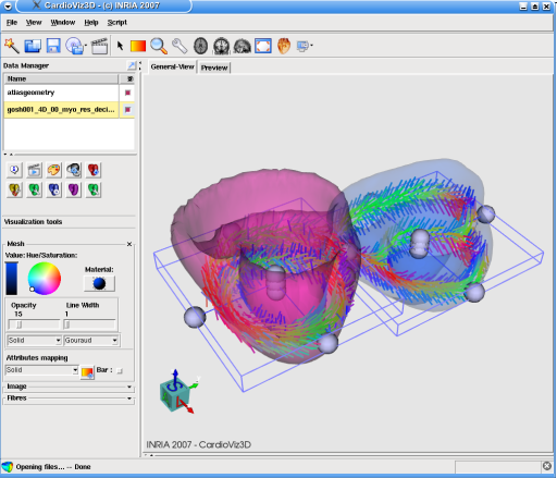 CardioViz3D: screenshot n. 14