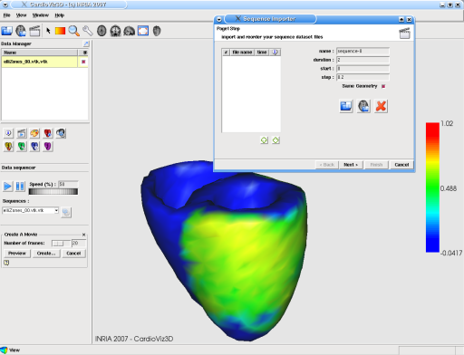 CardioViz3D: screenshot n. 9