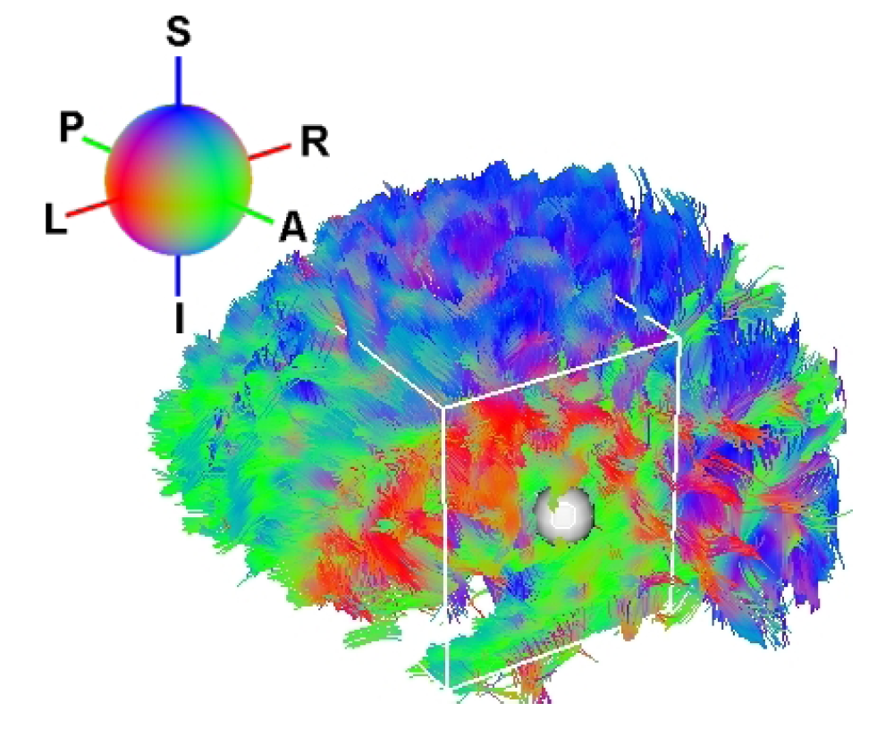 medinria diffusion weighted imaging