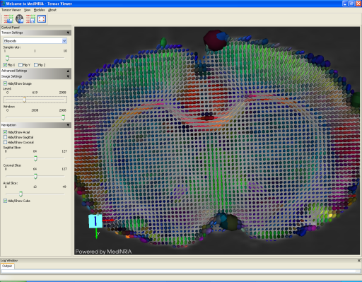 medinria software