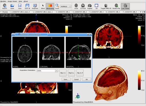 MedINRIA: screenshot n. 16