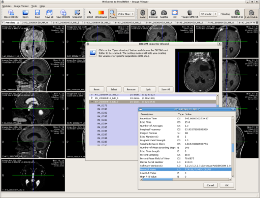 osirix lite review