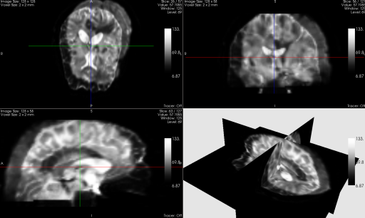 fa treshhold in medinria for mouse brain