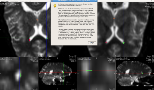 medinria diffusion weighted imaging