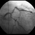 two angiograms