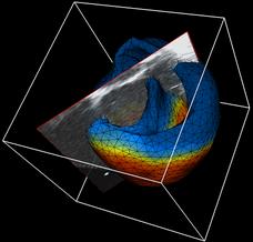 model in
      echocardiography