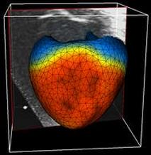 model in
      echocardiography