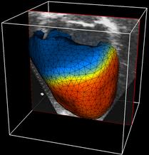 model in
      echocardiography