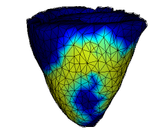 electromechanical contraction