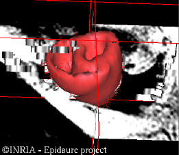 biomechanical
      model in image