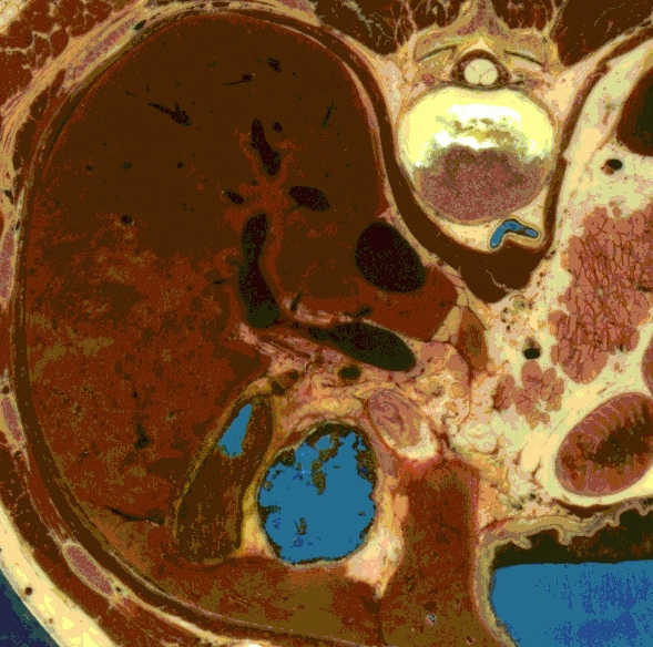AISIM: Anatomie du foie