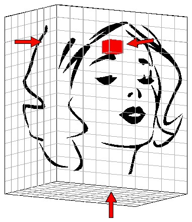 partial volume effect