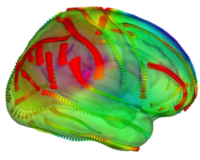 human brain mapping. of human brain variability