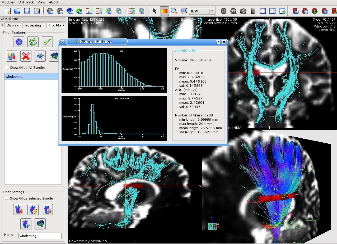 Image dtimodule