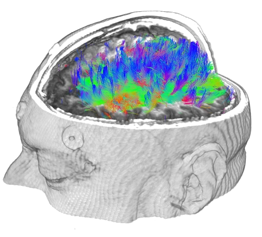 Image matrixfile1