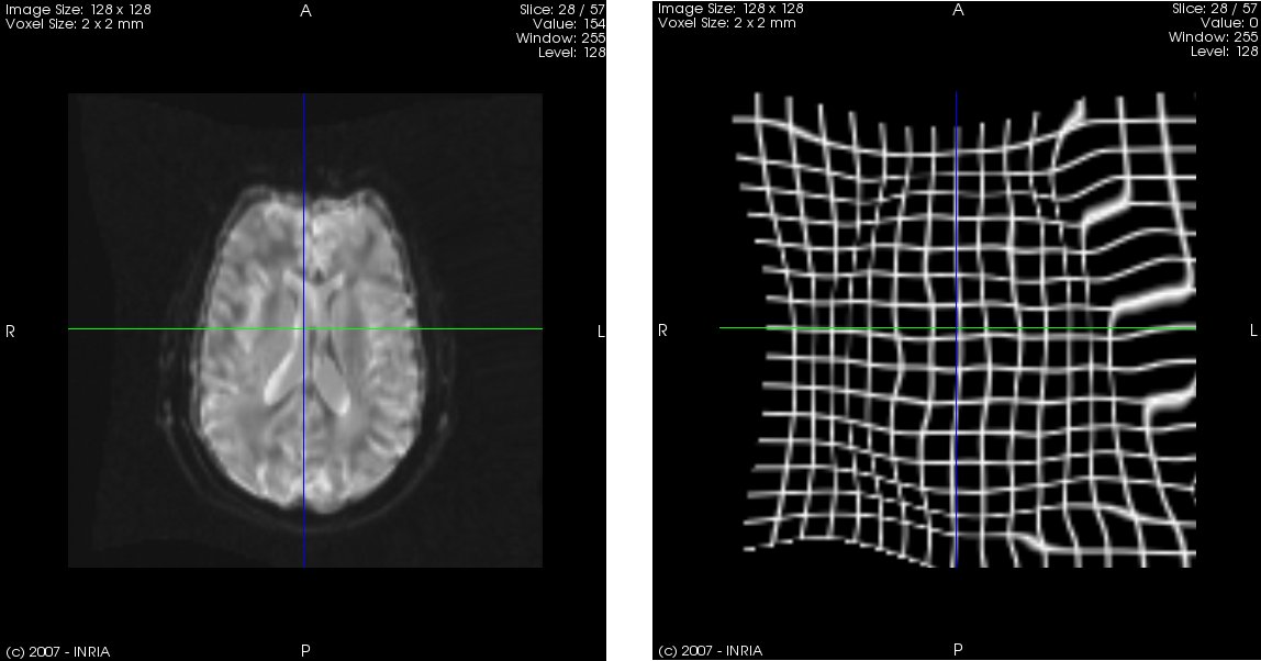 Image registrationtool-field