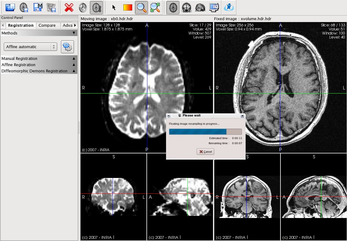 Image registrationtool