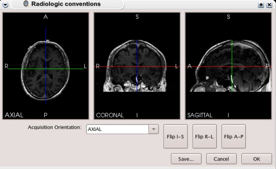 Image reorientationtool